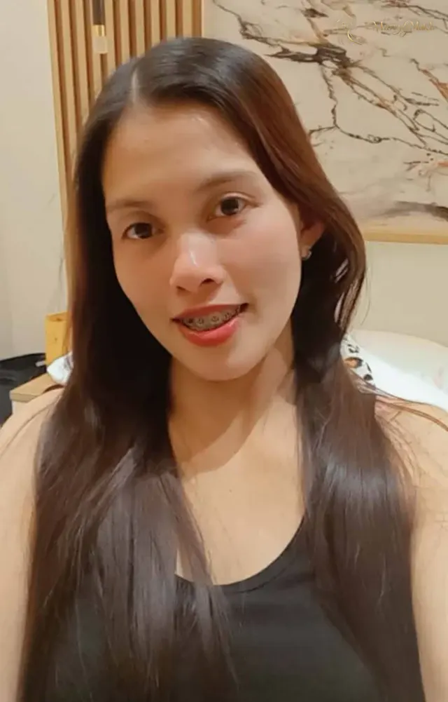 Lolifel, 28